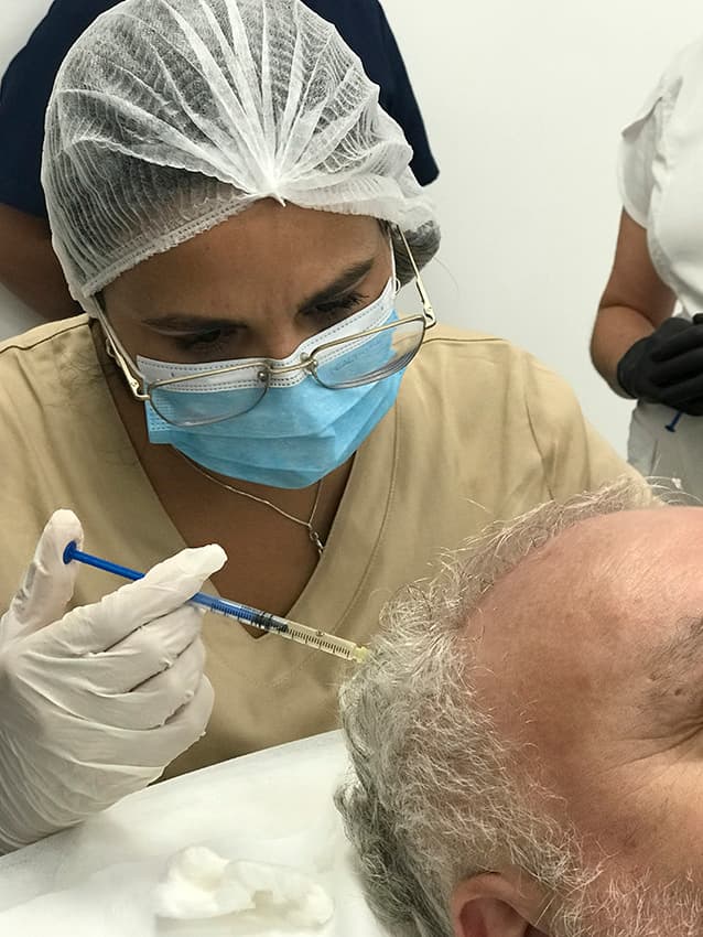 tratamientos para alopecia